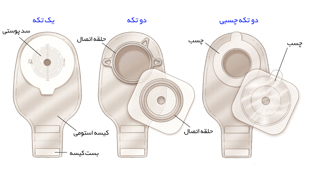 انواع-کیسه-کلستومی