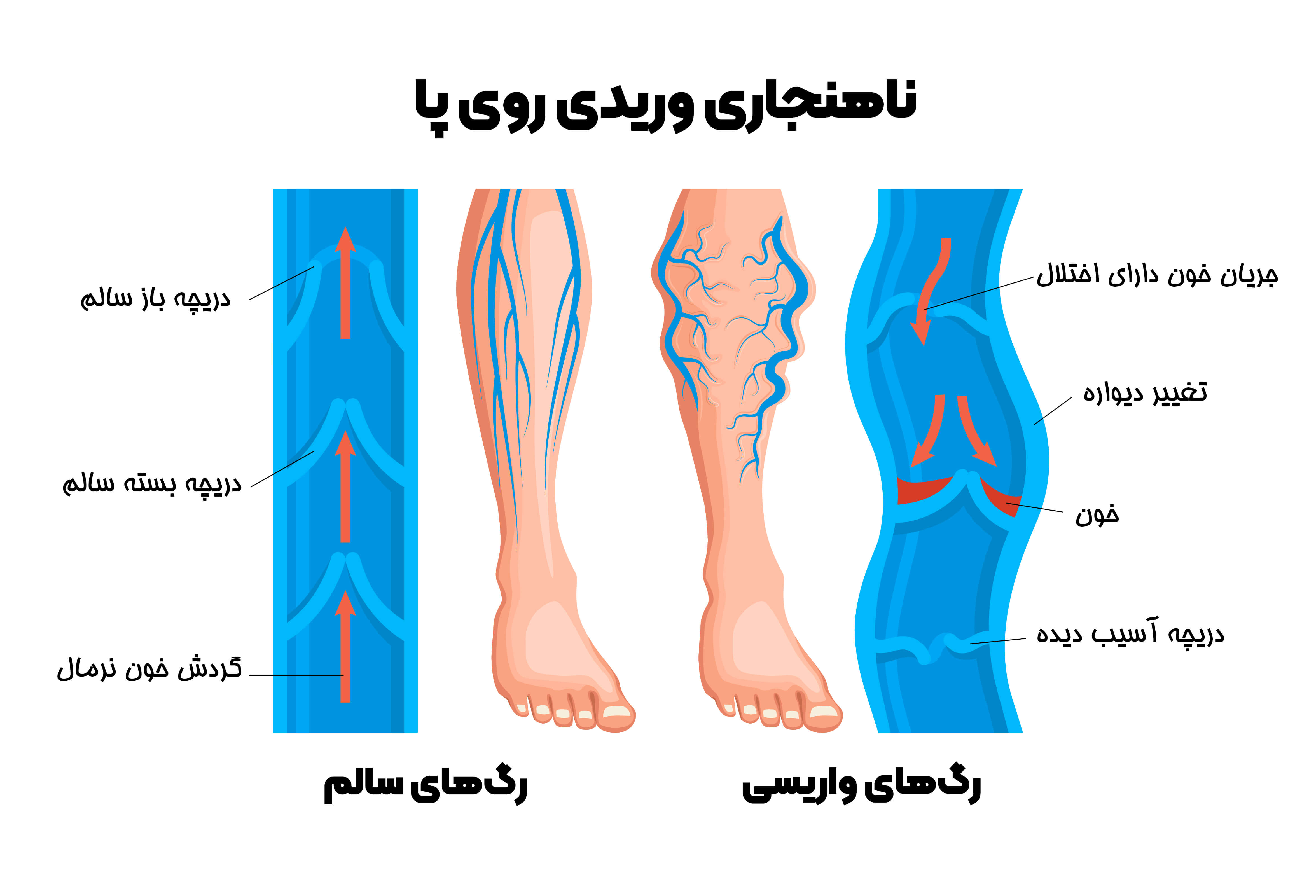 Venous-Disease-On-The-Leg