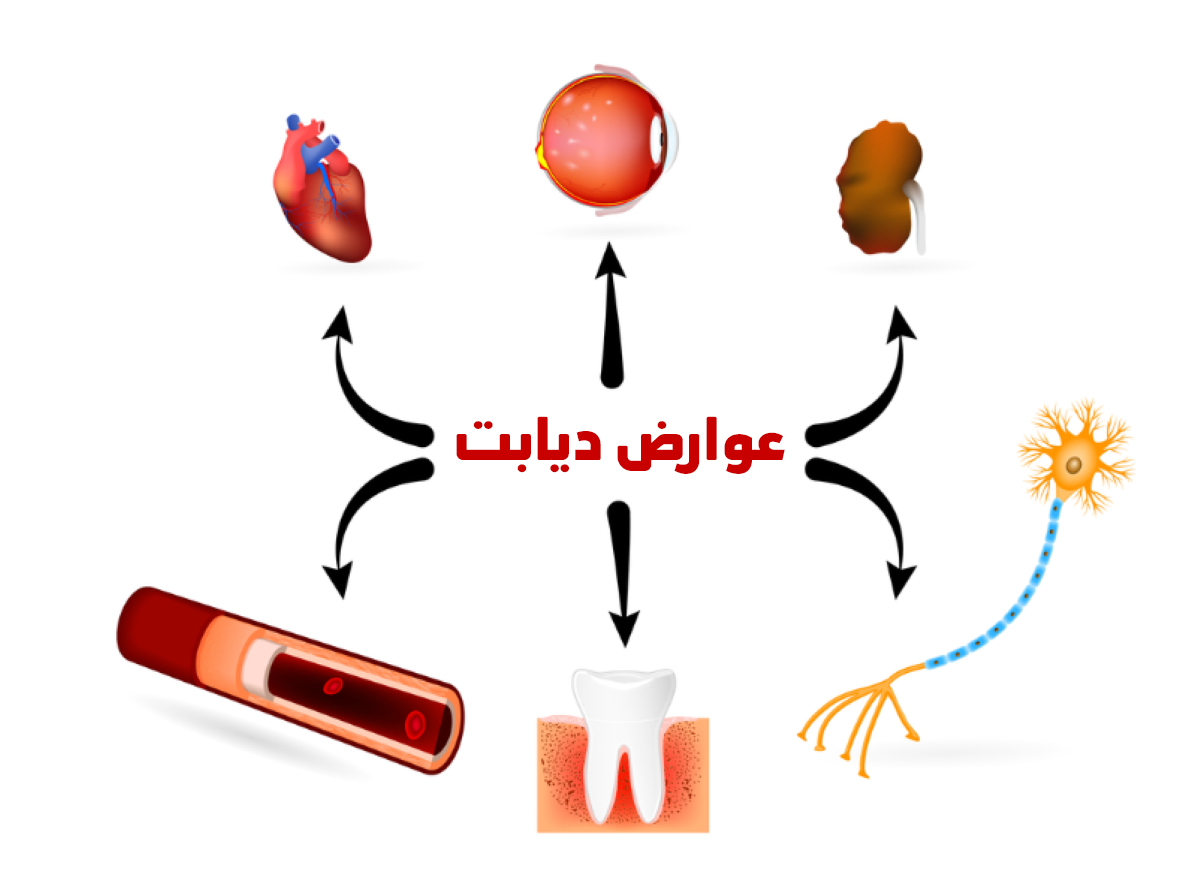 دیابت